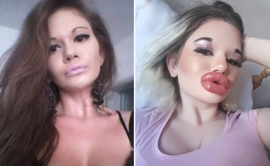 See Photos Of The German Adult Model With World's Biggest Fake