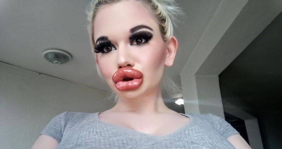 Meet Andrea Ivanova The Woman With The Biggest Lips In The World