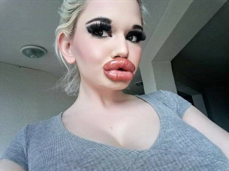 Meet Andrea Ivanova The Woman With The Biggest Lips In The World