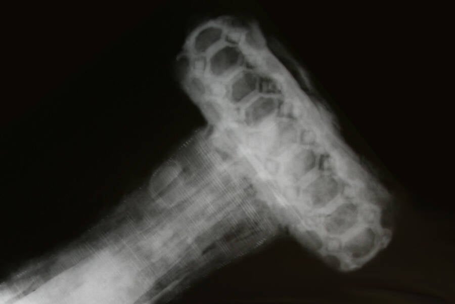 X Ray Of Viking Mayback Sword