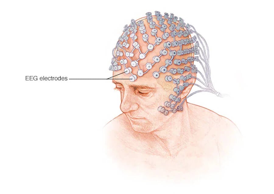 Electroencephalography Illustration