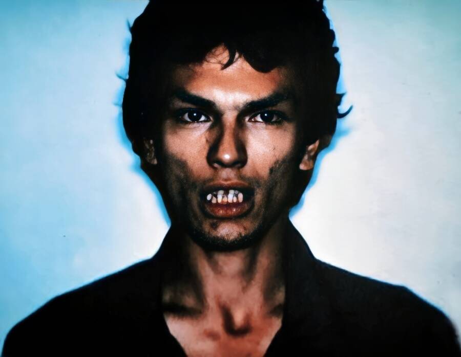 Richard Ramirez Teeth