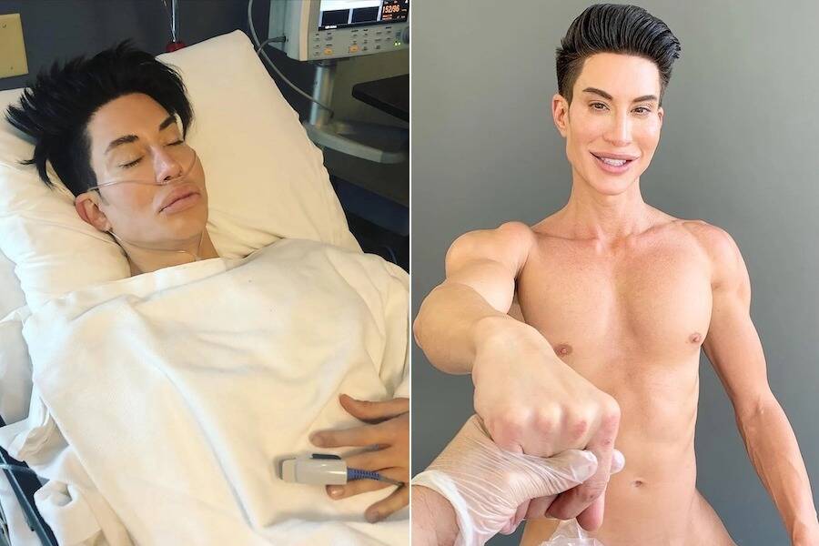 Justin Jedlica Before And After
