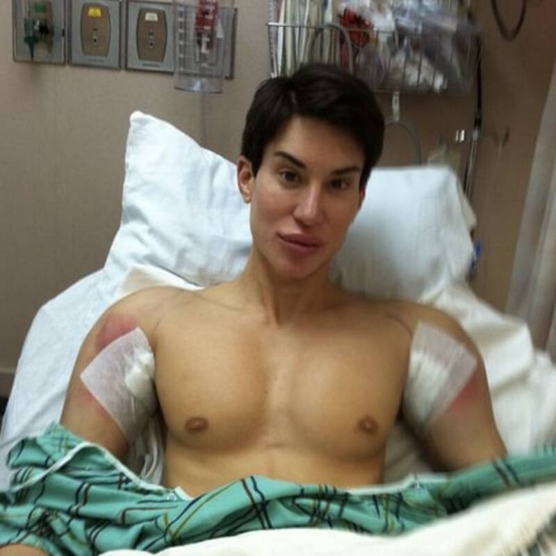 Justin Jedlica, The Man Who Turned Himself Into The 'Human Ken Doll'