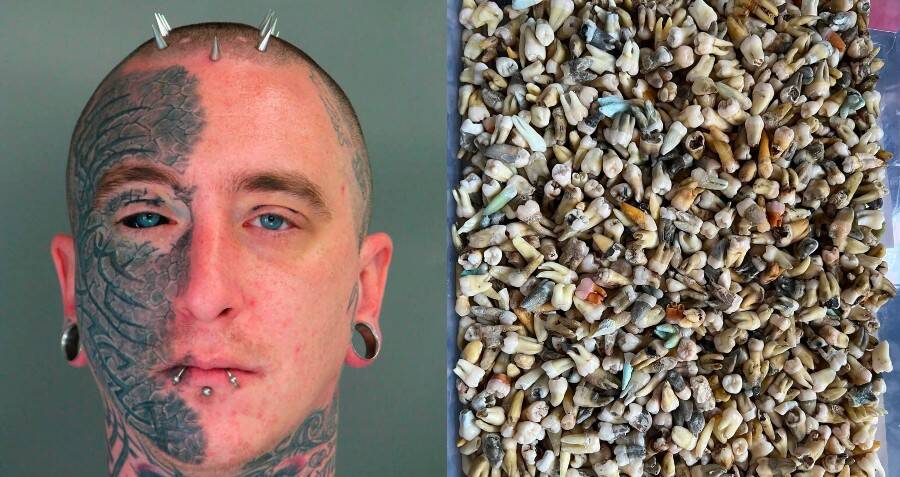 Man Arrested For Buying And Selling Body Parts Online - Vimarsana News
