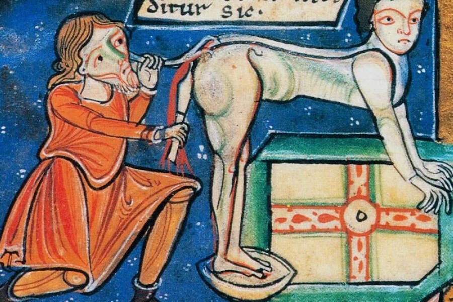 Medieval Haemmorhoid Surgery Painting