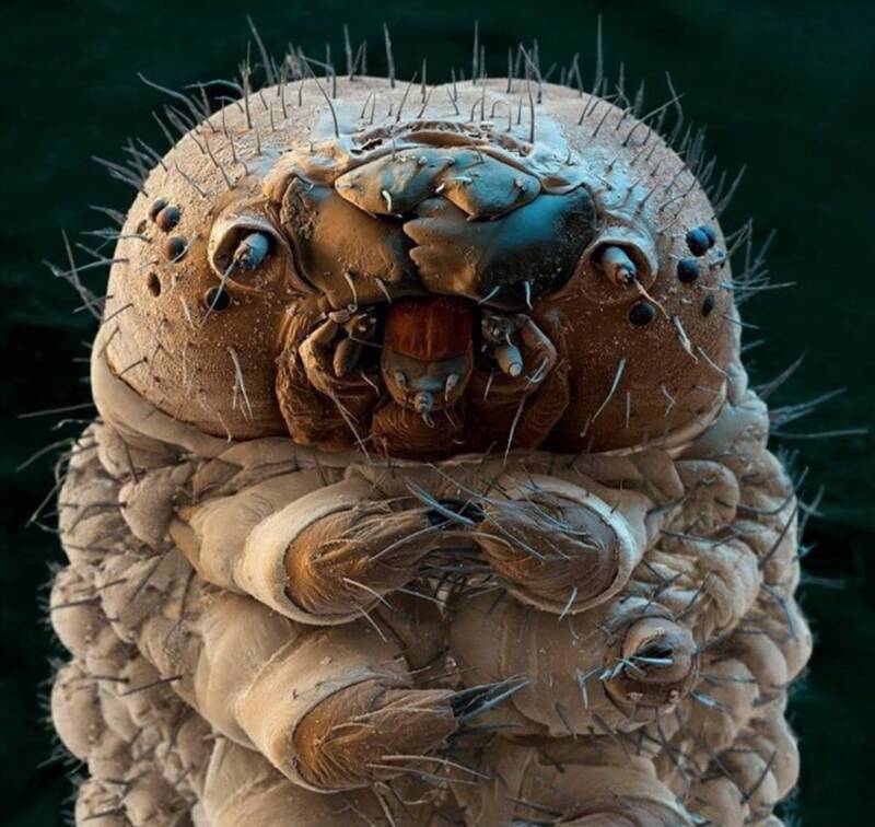 parasite electron microscope