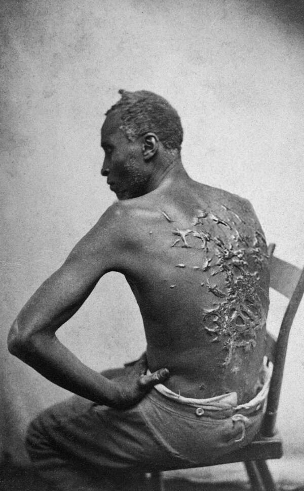 Cicatrices sur le dos de l'esclave