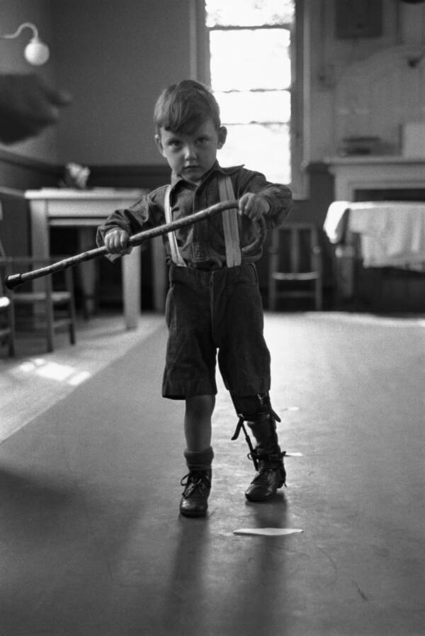 A Young Boy With Polio