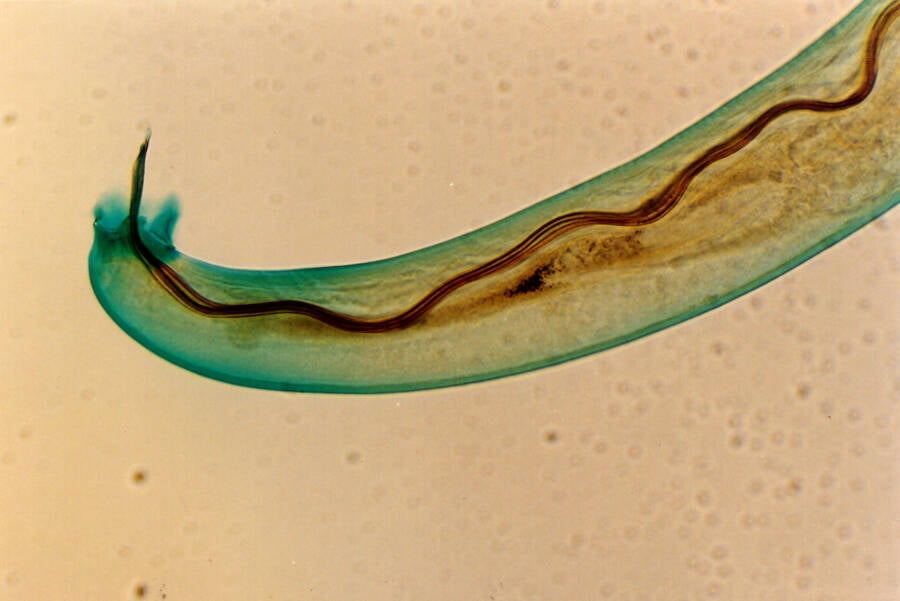 Rat Lungworm Parasite