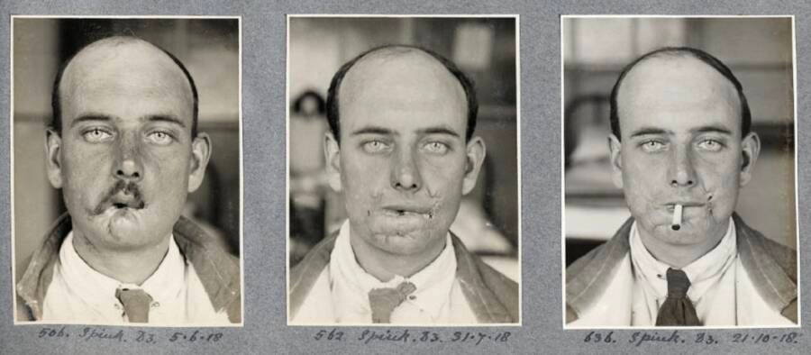 Harold Gillies: The Surgeon Who Rebuilt The Faces Of WW1 Veterans