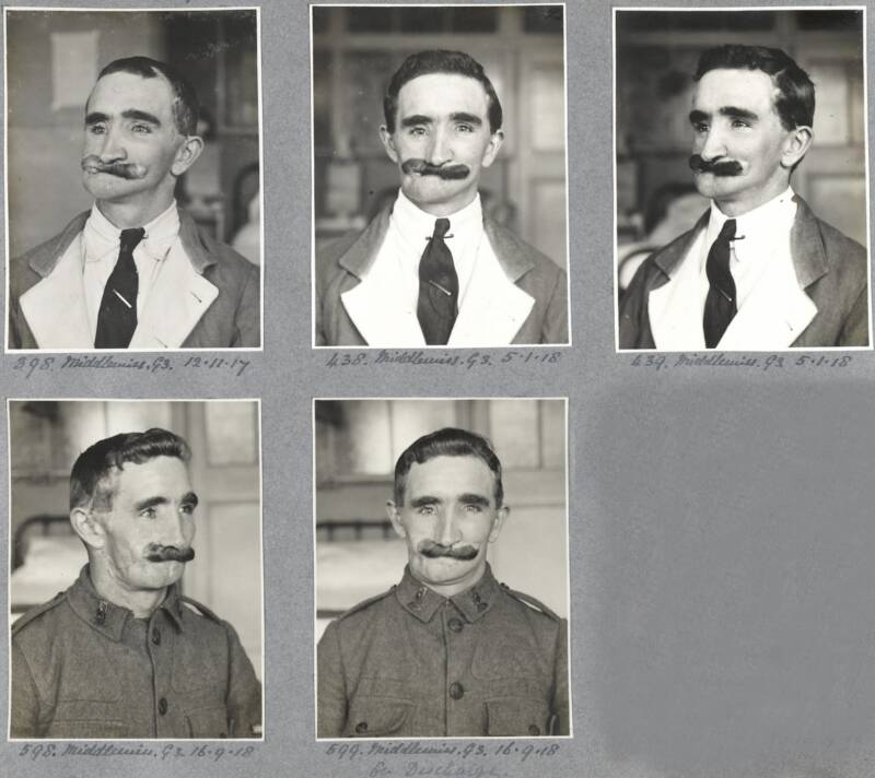 Harold Gillies: The Surgeon Who Rebuilt The Faces Of WW1 Veterans