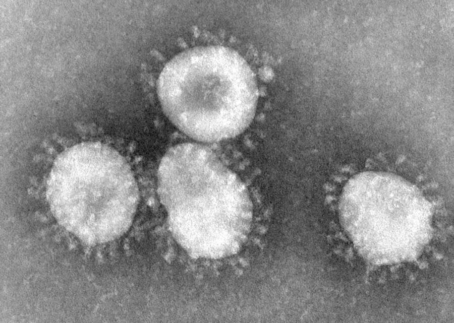 Microscopic Coronavirus