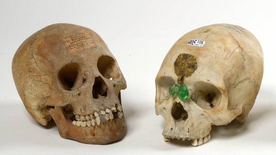 Two Skulls From The Congo