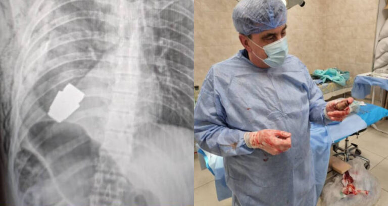 Grenade Removed From Ukrainian Soldier