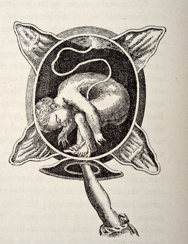 Medical Engraving From The Court Midwife