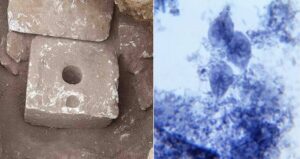 Ancient Toilet And Giardia Sample