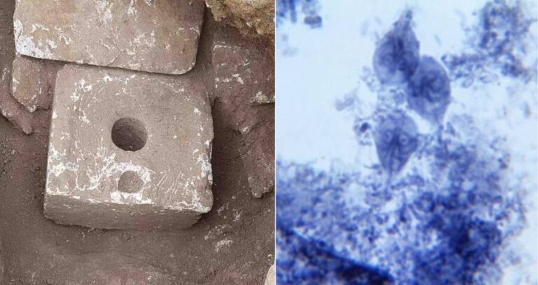 Ancient Toilet And Giardia Sample