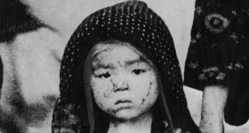 Bombing Of Nagasaki Survivor