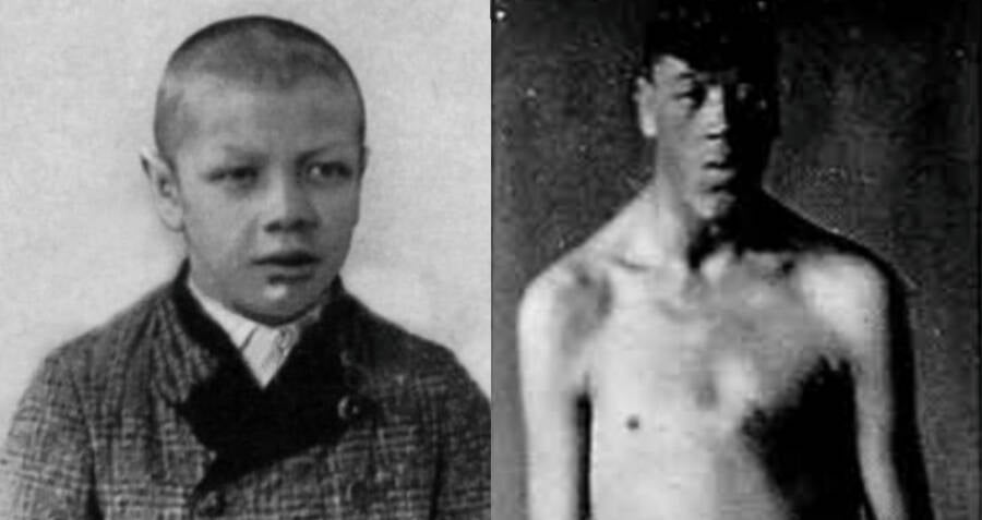 Adam Rainer, The Man Who Grew From A Dwarf To A Giant