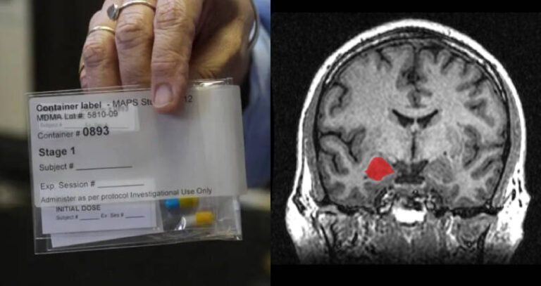 Dose Of Mdma And Brain