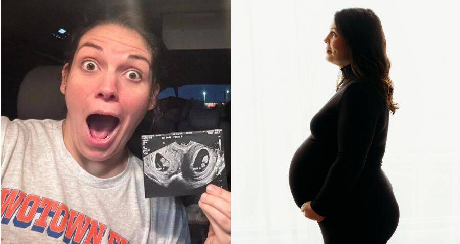 Alabama Woman With Two Uteruses Is Pregnant In Both Of Them