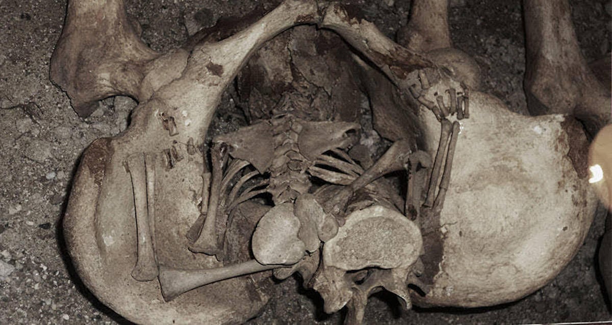 What Is A Coffin Birth — And What Causes This Horrifying Phenomenon?