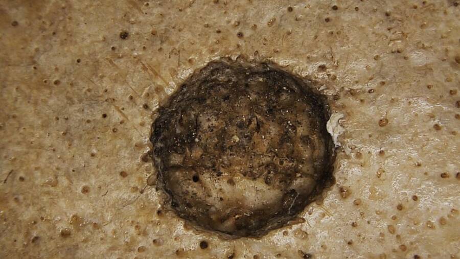 Ancient Tumor Closeup