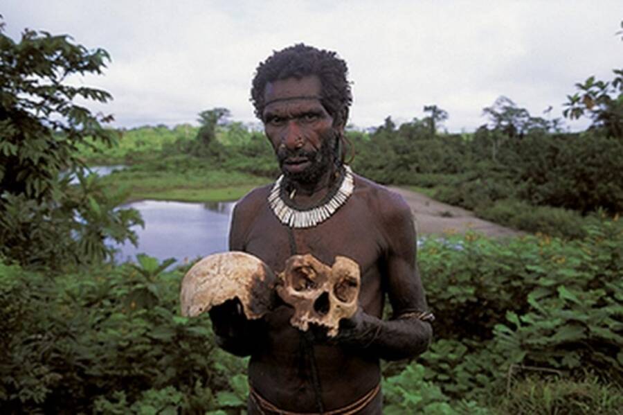 Cannibal Tribe Member With A Skull