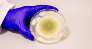 A. flavus Fungus Sample Featured