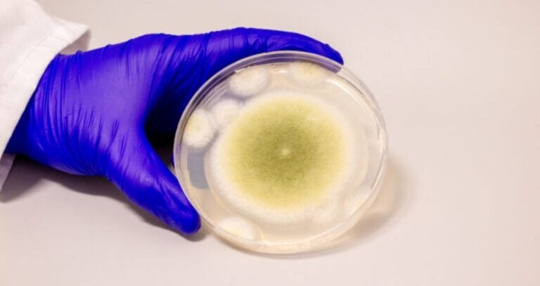 A. flavus Fungus Sample Featured