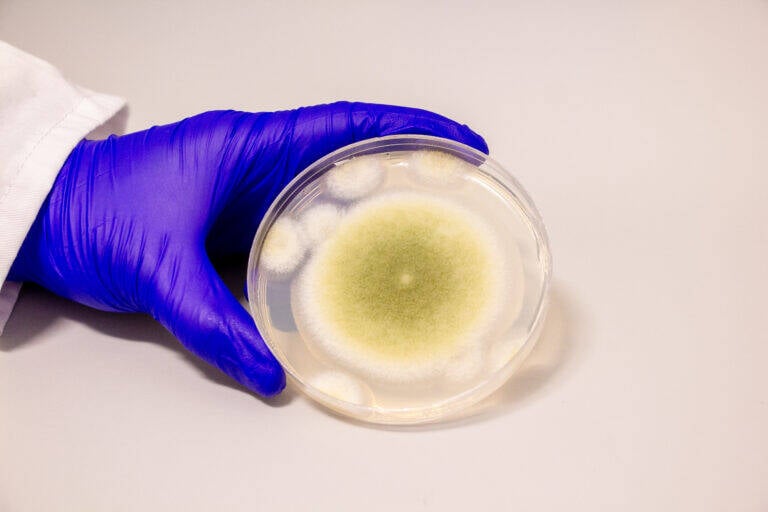 Aspergillus Flavus Fungus