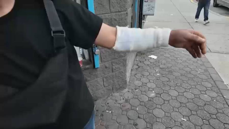 Abed Assad Wound