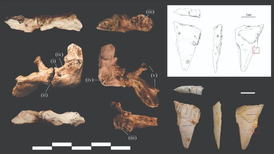 Prehistoric Homicide Victim In Vietnam