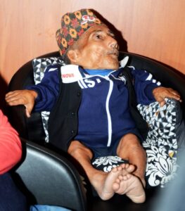 Chandra Bahadur Dangi, The Shortest Man To Ever Live