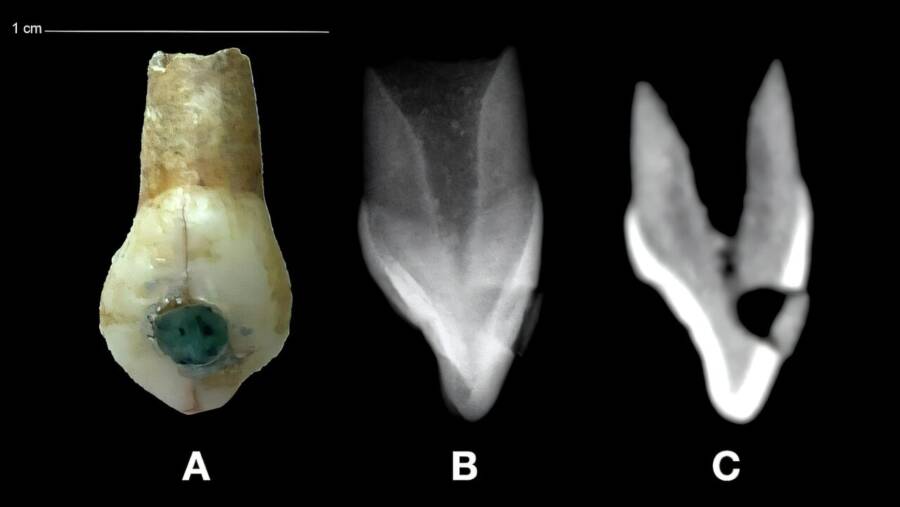Right Canine Maya Tooth