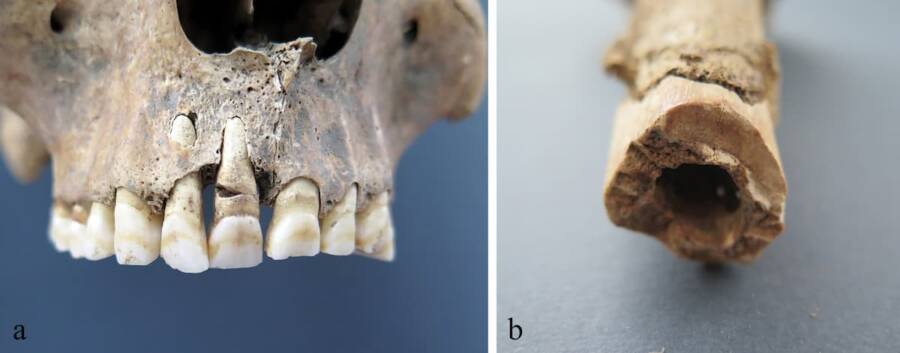 Roman Soldiers Injuries