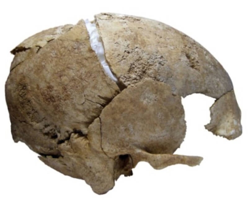 Skull Of Celtic Warrior Found In Spain