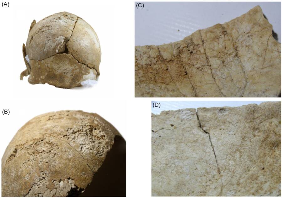 Celtic Warrior Decapitated By Romans