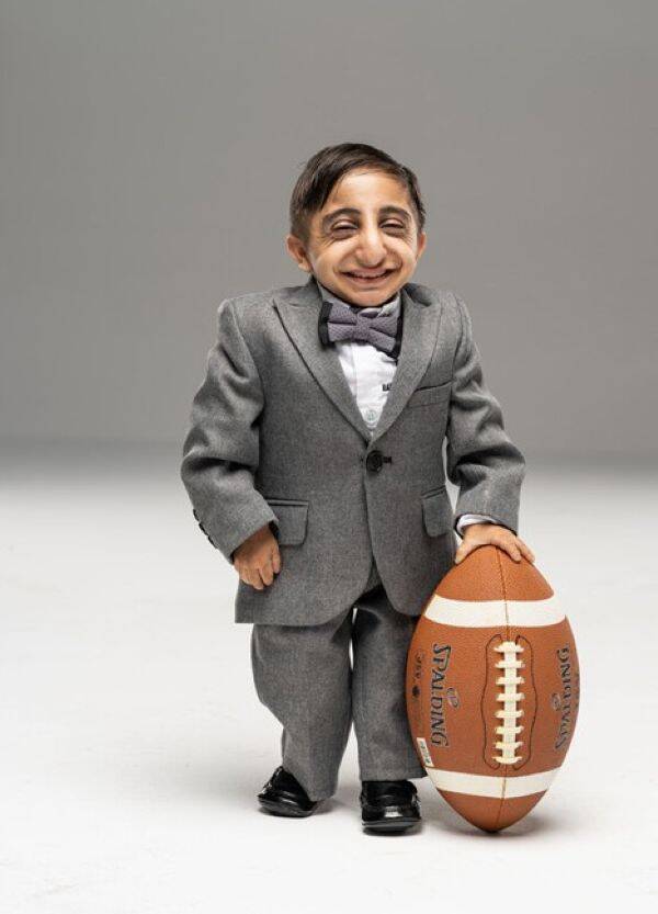 Afshin Esmaeil Ghaderzadeh One Of The Shortest People In The World