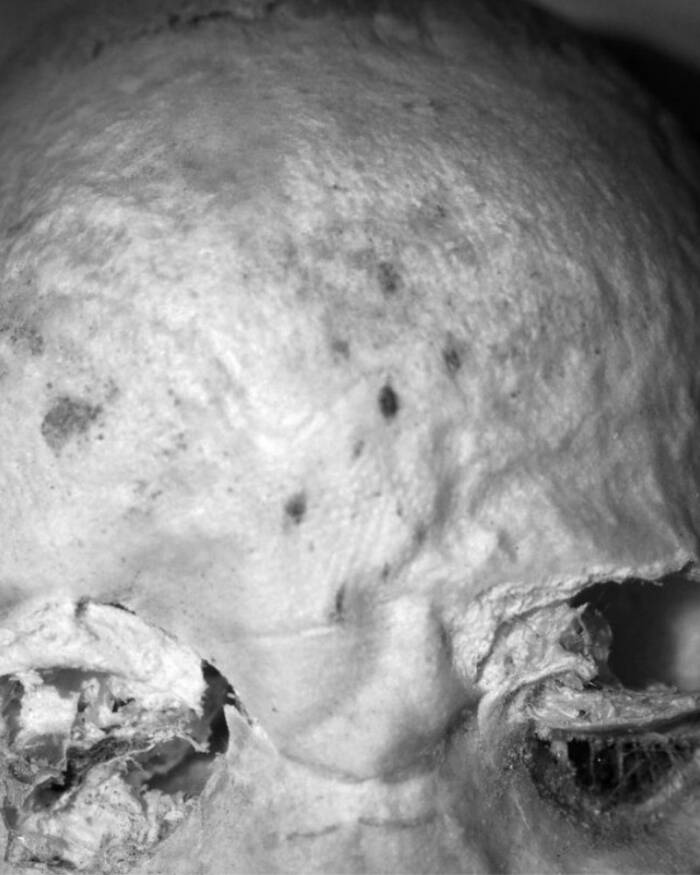 Child Tattooed Skull