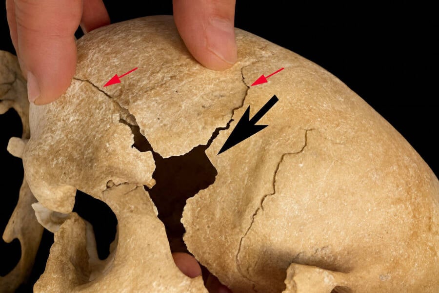 Fatal Wound To Warrior Monk's Skull