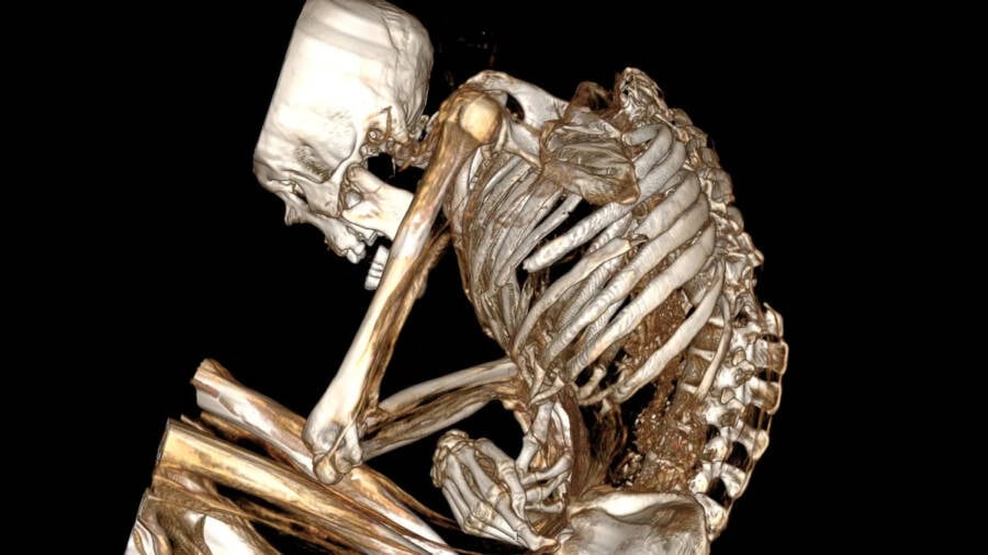 CT Scan Of Mummy
