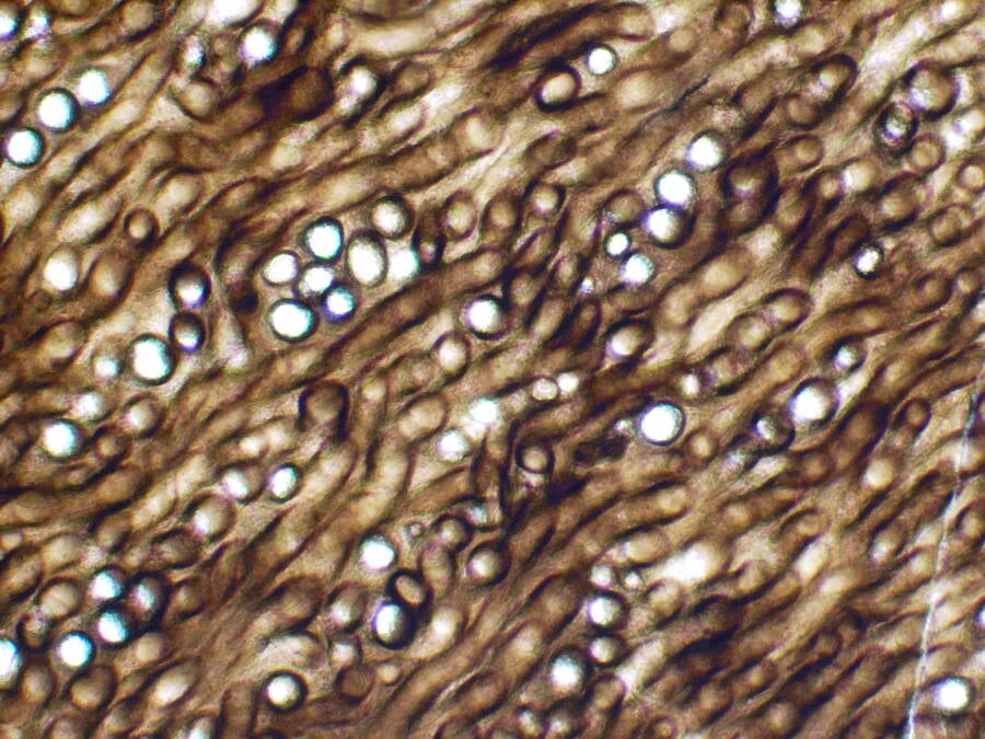 Prototaxites Microstructure