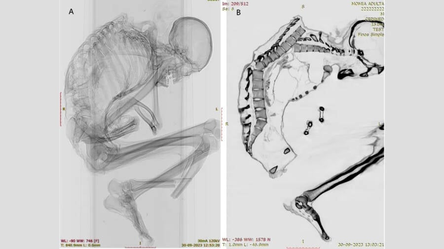 Chile Turquoise Mine Mummy