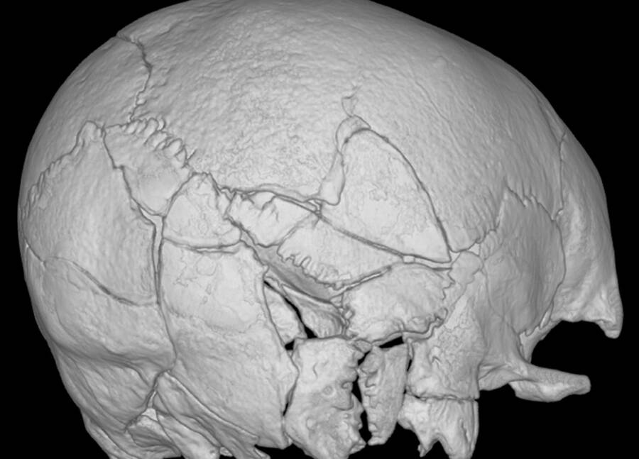Scottish Trebuchet Victim Skull